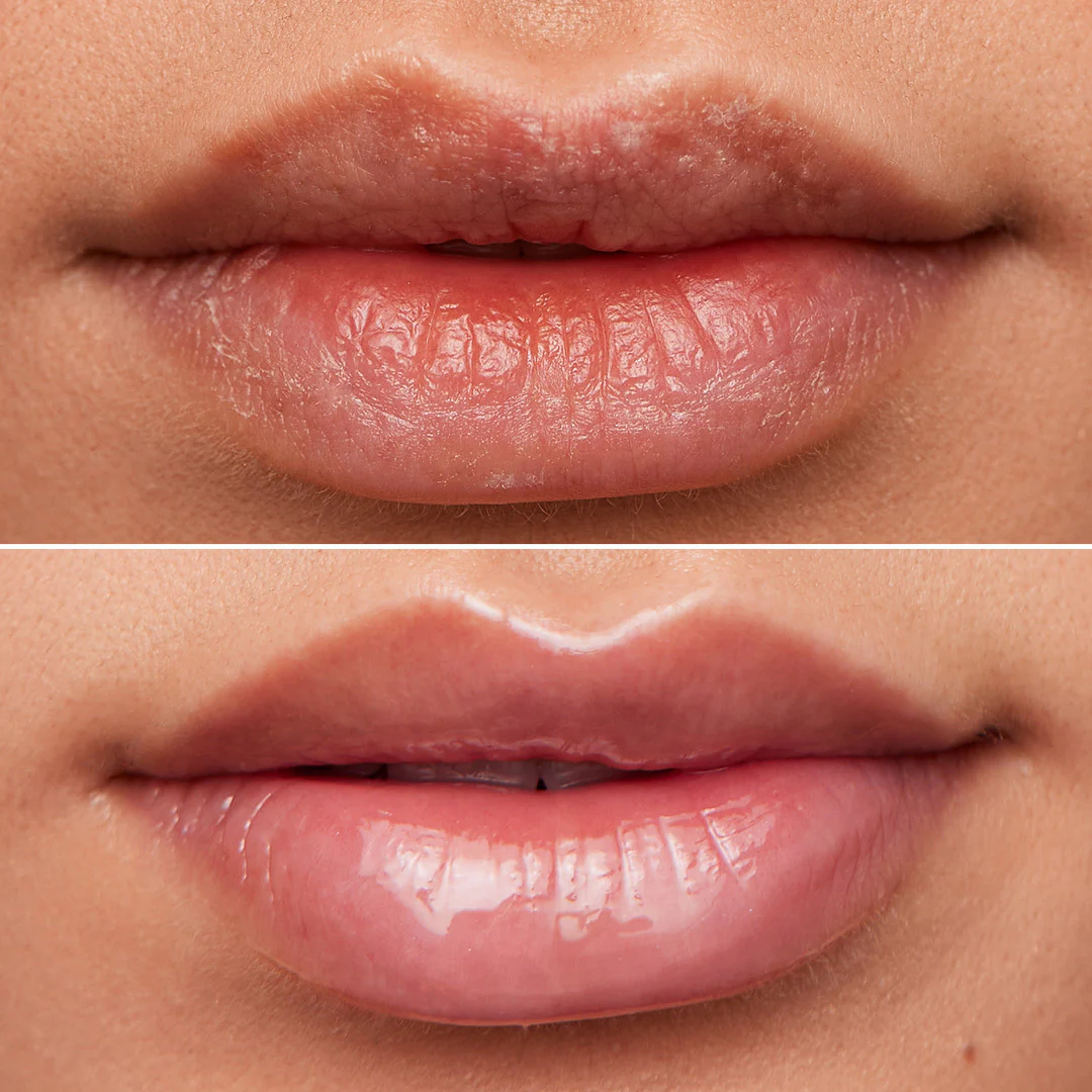 Lip Rehab Serum Oil - Image 12